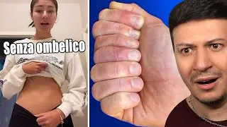 PERSONE CON CARATTERISTICHE UNICHE *impressionante*