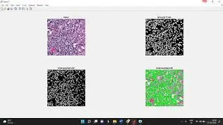 Histo Nuclei & fundus Exudates Segmentation - Modified U-net Model - Own Data