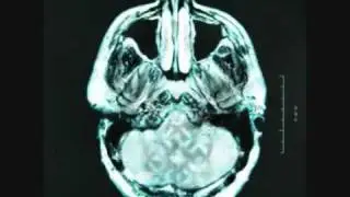 Breaking Benjamin -  Crawl