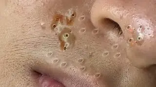 تلميع وتنظيف الجلد الطبيعي المدور 1413602