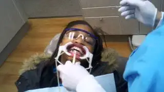 Getting Braces On: How Dr. Nirenblatt Orthodontist Puts Braces On: Part 2