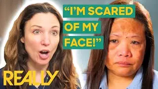 Dr. Emma Helps Restore Melasma Patient's Confidence | The Bad Skin Clinic