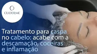 CASPA no CABELO: como acabar? TRATAMENTO