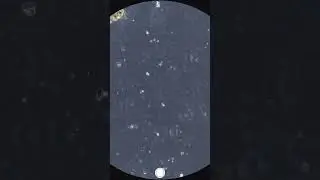 Bird 💩 Under Microscope 