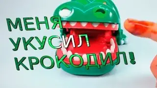 МЕНЯ УКУСИЛ КРОКОДИЛ! Игрушка с Aliexpress