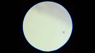 Cell Phone Adapter for Microscope Test#5