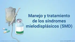 Manejo y tratamiento de los síndromes mielodisplásicos (SMD)