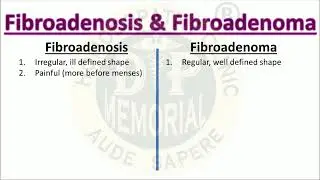 Difference between Fibroadenosis and Fibroadenoma