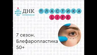7 сезон проекта 