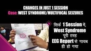 Changes in just 1 Session - West Syndrome - Multifocal Seizures Case | सिर्फ 1 सेशन में आ गया अंतर