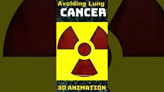 Empowering Lung Health: Strategies for Preventing Lung Cancer