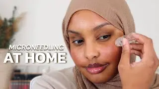 Get Glowing Skin: Trying Microneedling at Home | Let's Talk Skin