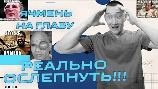 Ячмень на глазу - осложнения приводящие к смерти.