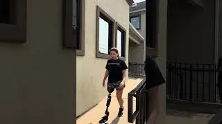 Alexandra's First Steps:  Blatchford KX07 Knee with Confidence and Control