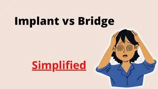 Dental Implant vs Dental Bridge? Which one is better and why?