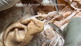 CAROTID TRIANGLE Sheath Arteries INTERNAL JUGULAR Vein VAGUS Nerve Clinical Aspects – Sanjoy Sanyal