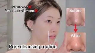 Blackheads Sebaceous filaments removal routine 👃 all nose things
