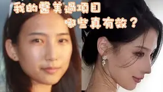 【Aesthetic】我做過醫美項目哪些真有效？肉毒｜熱瑪吉｜熱拉提｜fortune4D｜如何提昇顏值？麵部減肉｜收緊｜提昇｜填凹｜放大五官｜嘴唇豐盈