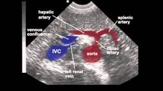 Abdominal Aortic Aneurysm (AAA) Ultrasound