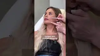 ВСЯ ПРАВДА О СМАС ЛИФТИНГЕ ‼️