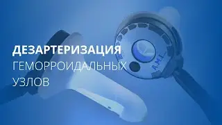 Дезартеризация геморроидальных узлов