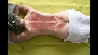 MASSAGE OF BACK - RELAXATION TECHNIQUE