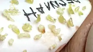 Extreme Pimple Popping How Far Will You Go