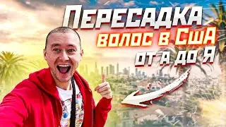 ПЕРЕСАДКА ВОЛОС В США ОТ А ДО Я / СКОЛЬКО СТОИТ ТРАНСПЛАНТАЦИЯ ВОЛОС