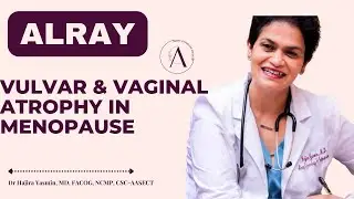 Vulvar vaginal atrophy #menopause #womenshealth