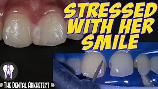Stressed Patient Wants A Better Smile.. May The 4th Be With Her #C9