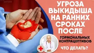 Риск угрозы выкидыша на раннем сроке из за гормональной контрацепции. Что делать?