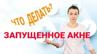 Advanced acne what to do with it