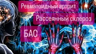 Болезнь Лайма (ревматоидный артрит, БАС, рассеянный склероз) Часть 1.