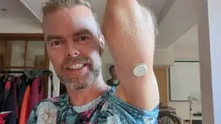 Two weeks with a continuous glucose monitor