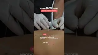 Основи Міофасціальноі Терапії. Семінар для фахівців