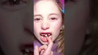 Giorgia is afraid of pulling out her own tooth, and Dad Salvo helps her! 