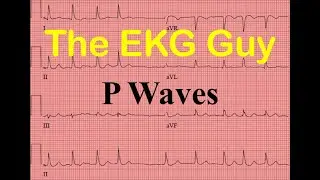 EKG/ECG P Waves - Question 4.0 l The EKG Guy