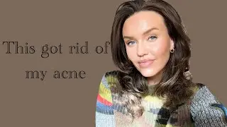 My Acne Has Finally GONE!! Dermatica 6 Month Update