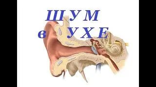 Шум в Ухе гот