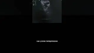 #ДГПЖ #узи #армдиассистент