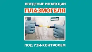 Восстановление позвонков с помощью плазмогеля