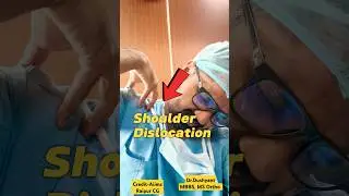 बार-बार कंधा उतरता है🔥 Shoulder Dislocation 💥#shoulderdislocation