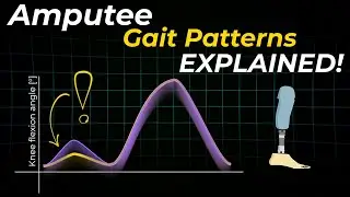 Amputee Gait Patterns Explained: Design Better Prostheses With These Insights!