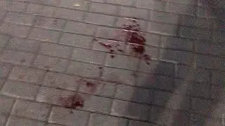 ПСИХИАТРИЧЕСКИЙ ДИАГНОЗ ЖЕНЩИНЫ, КОТОРАЯ В ИЗМАИЛЕ УДАРИЛА МУЖЧИНУ НОЖОМ В СПИНУ