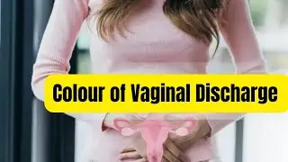 colour of vaginal discharge and pathology
