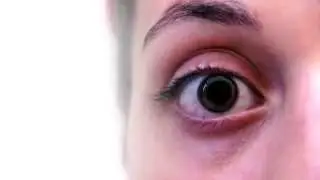 Hallucination VFX (After Effects CS6)