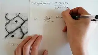 Magnification Calculation GCSE Biology (AQA) - Exam Questions & Method