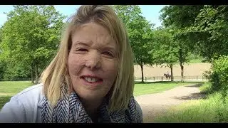 En toen stond ik in BRAND... In deze vlog vertel ik je over MIJN ONGELUK, kijk je mee?
