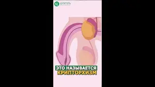 Яички не находятся в мошонке! КРИПТОРХИЗМ 