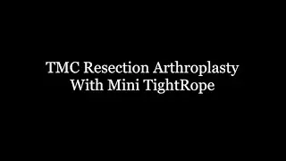 TMC Arthroplasty With Mini TightRope Surgery